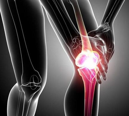 kerusakan sendi lutut dengan artritis dan artrosis