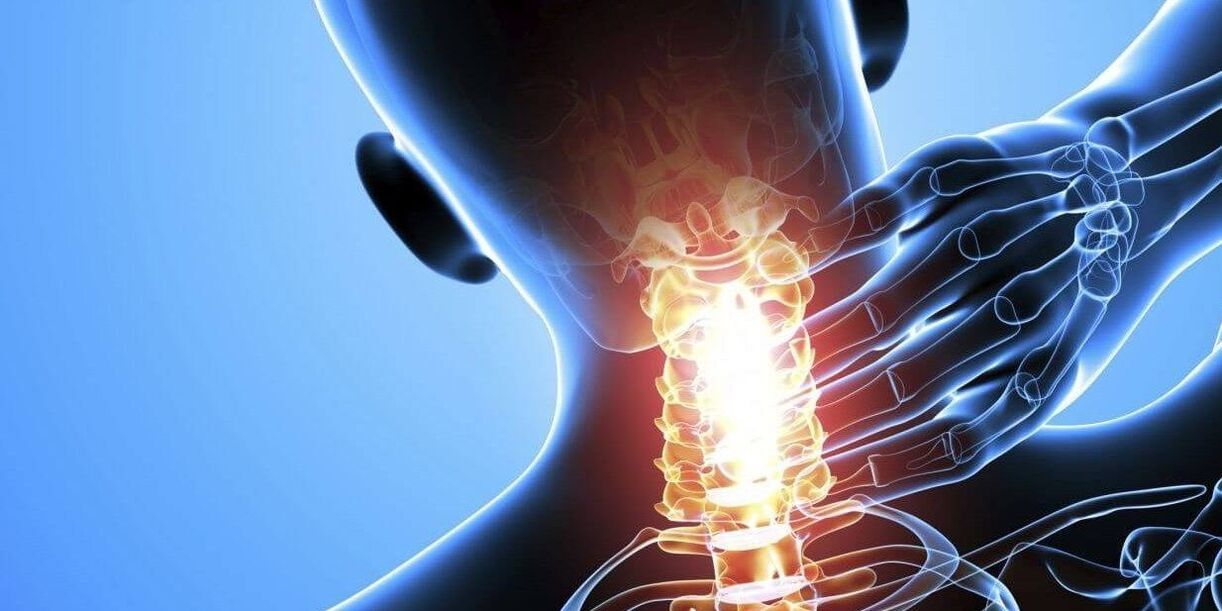 sakit leher karena osteochondrosis