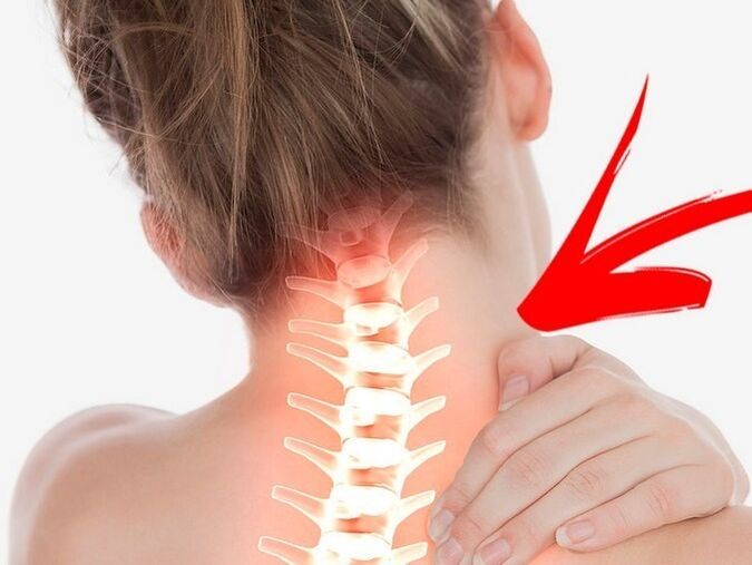 Kompresi akar saraf dengan osteokondrosis serviks
